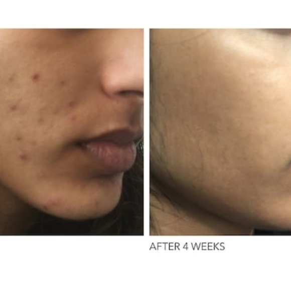 πDr David Gross - Alpha Beta π - Picture 3 of 8